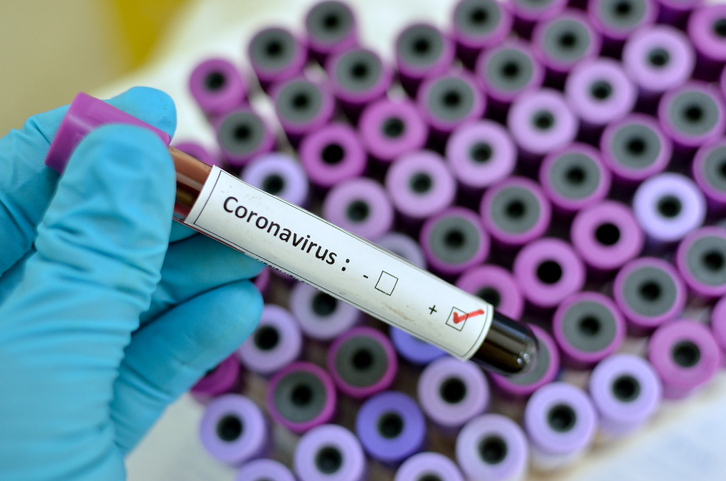  Todo lo que necesitas saber sobre el coronavirus